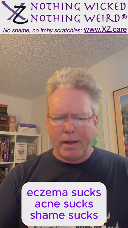 XZ Skin Relief for eczema and psoriasis